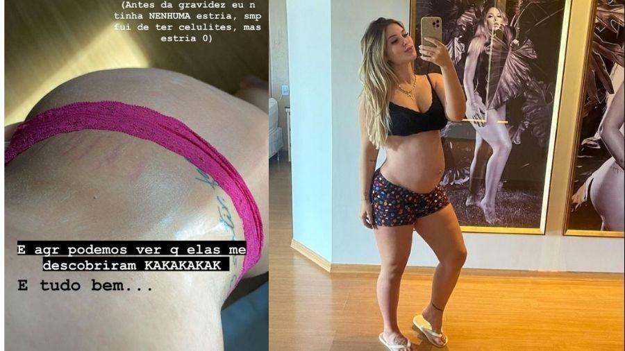 Entenda os procedimentos que ajuda na celulite, como fez Virgínia Fonseca (Reprodução)