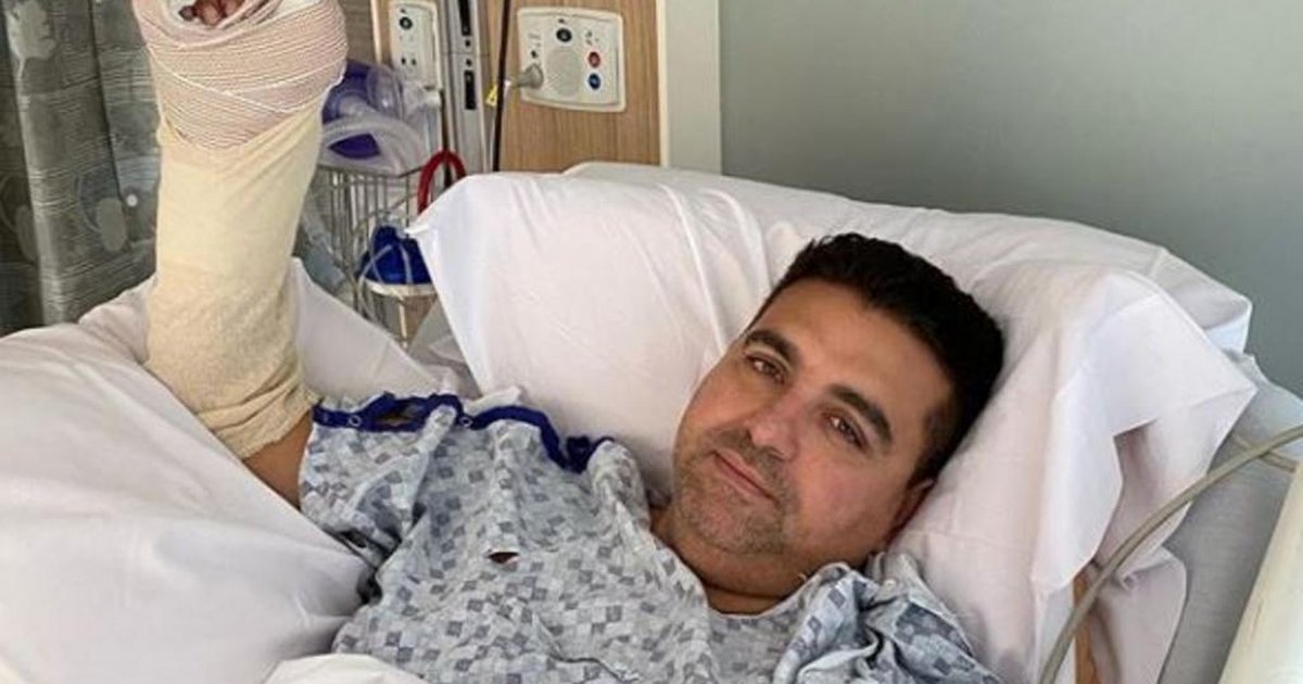 Buddy Valastro sofre acidente com a mão (Foto: Reprodução)